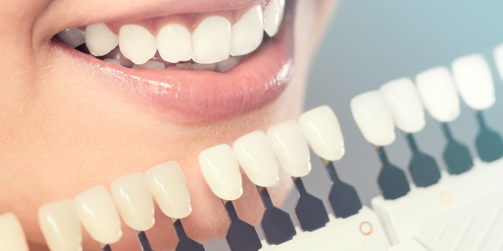 What is Cosmetic Dentistry Treatment & Services?