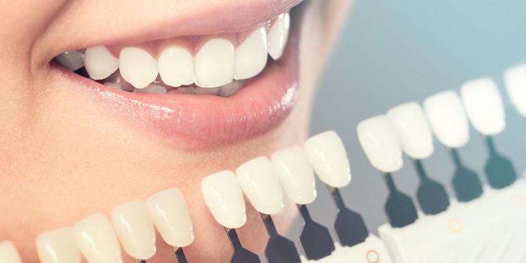 Invisalign Invisable Braces