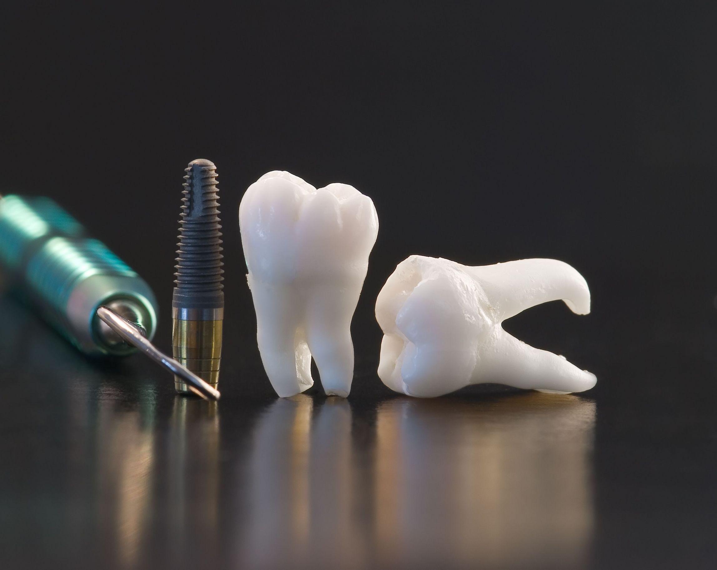 Cosmetic Dental Procedures