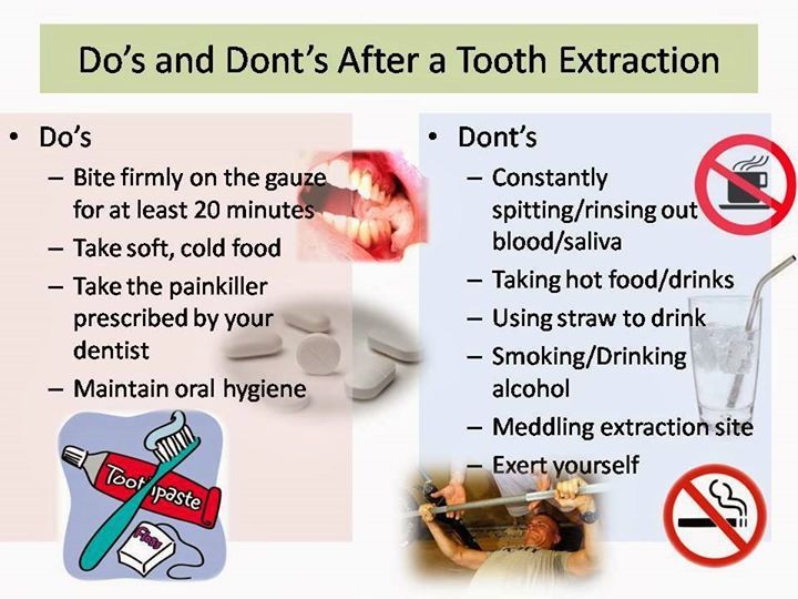 Important Points to Consider After Dental Implant Surgery