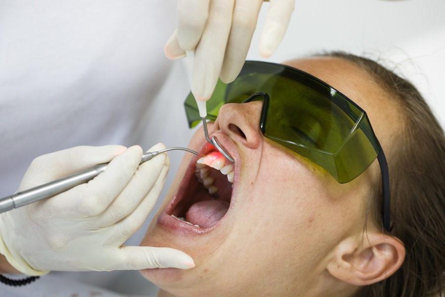 Laser-Treatment-for-Gum-Disease