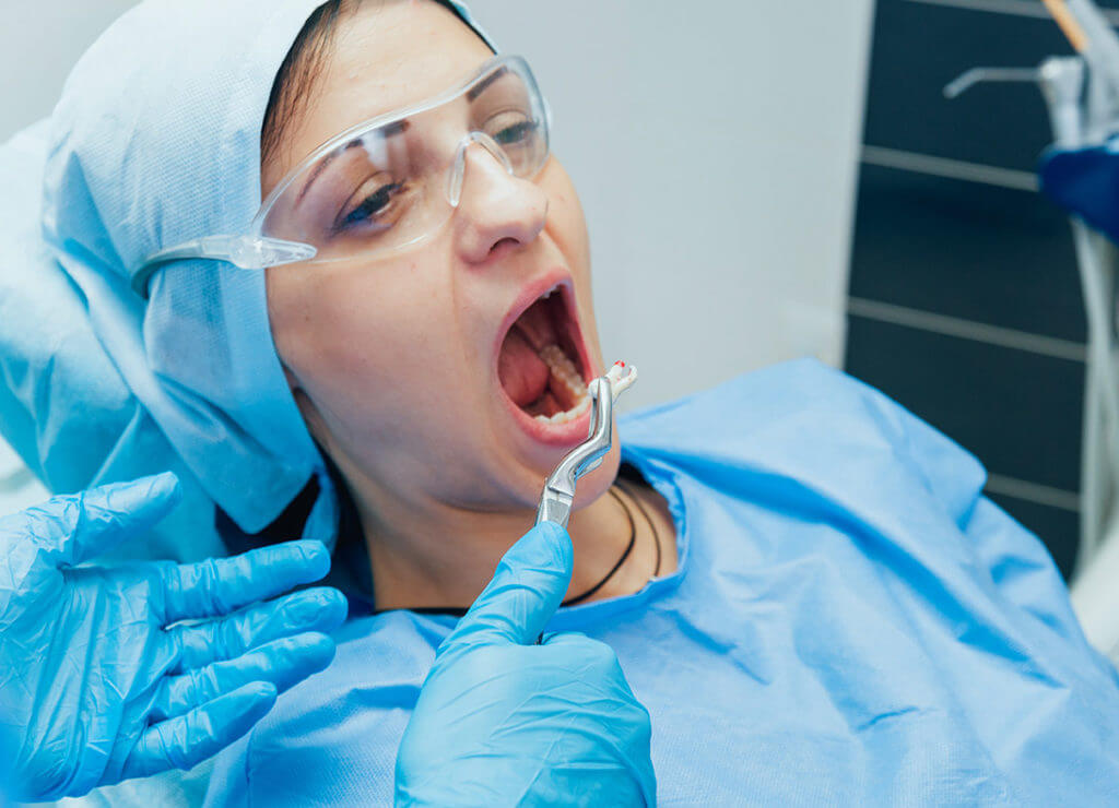 Tooth Removal Procedure