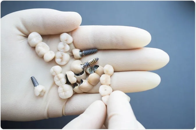 Dental Implants Arlington VA