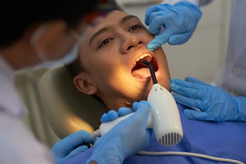 Tooth Sealant sand Dentures Services in Arlington VA