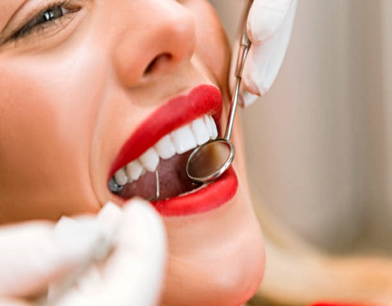 Tooth Fillings Washington DC