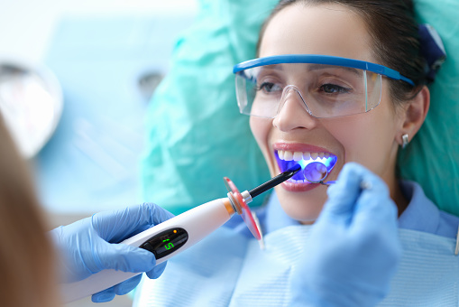 Tooth Fillings Washington DC