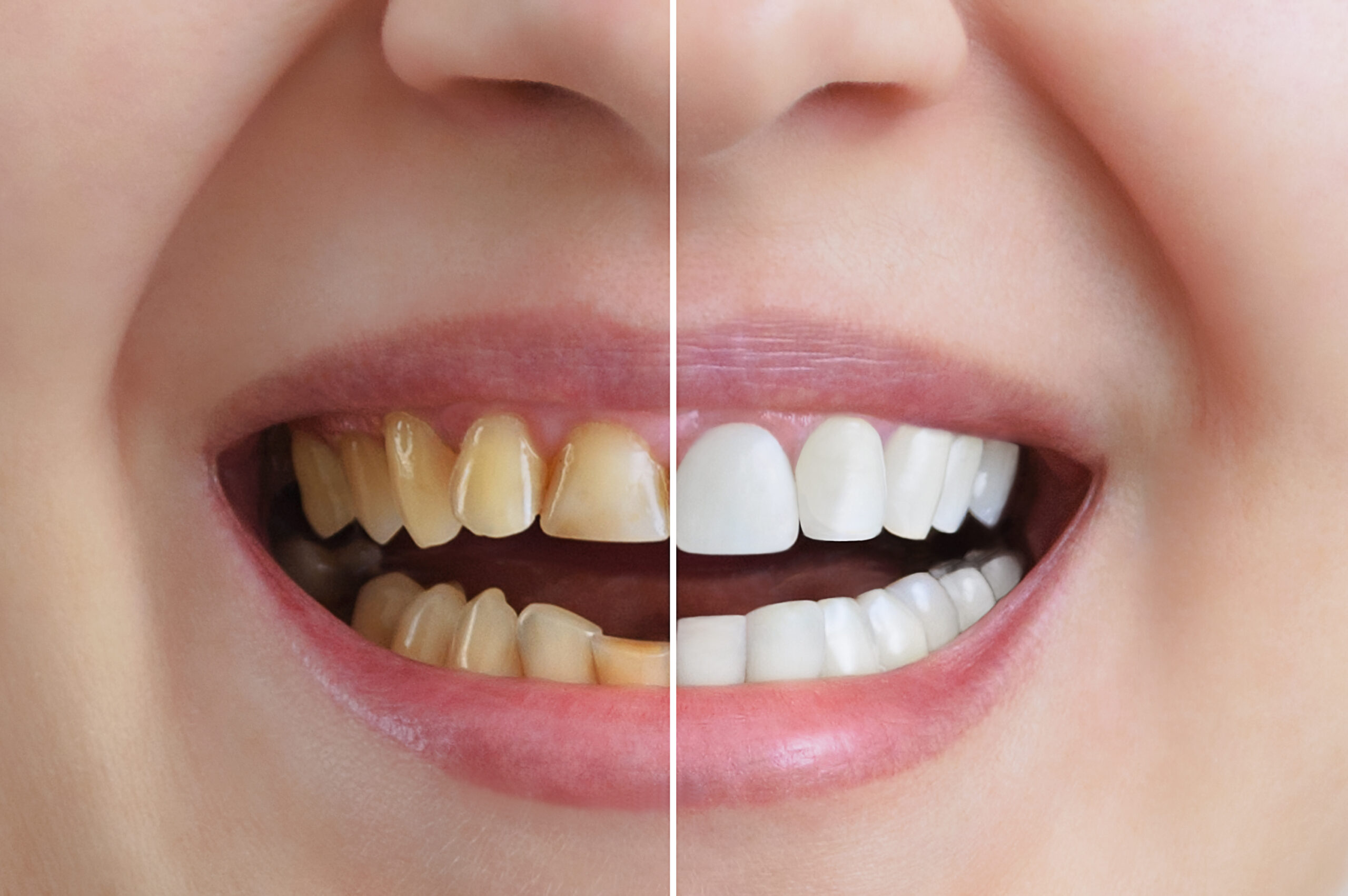 Cosmetic Dentist near me Crystal City