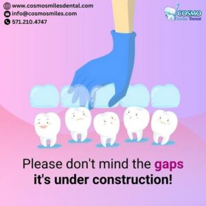 Invisalign Braces