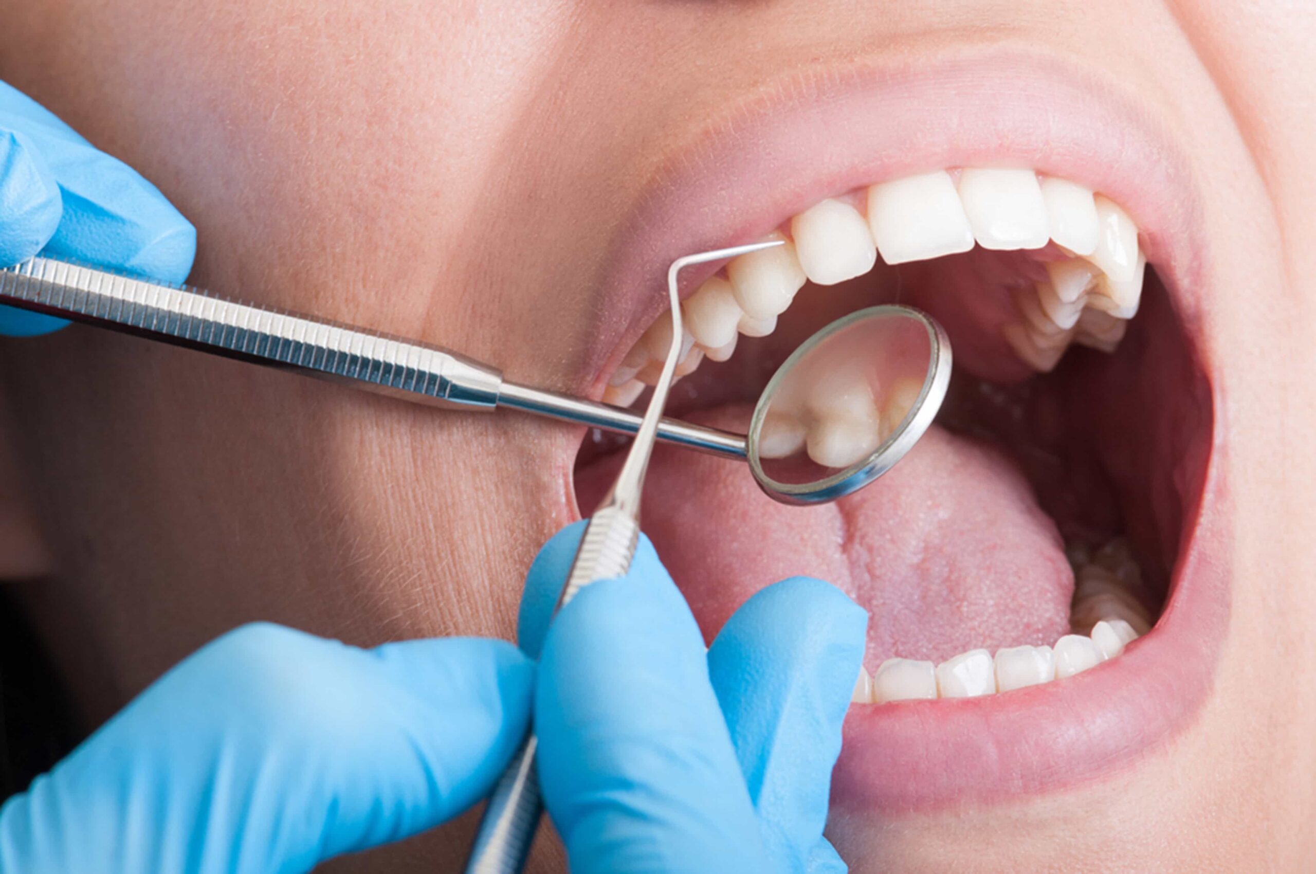 root-canal-therapy root-canal-therapy
