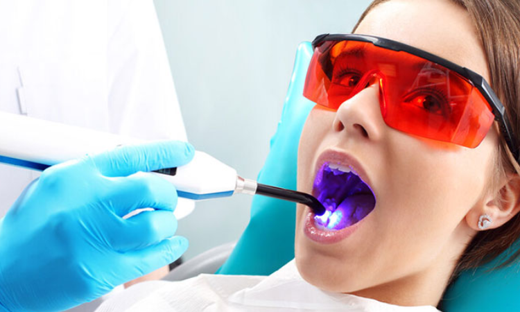 Tooth Fillings Arlington