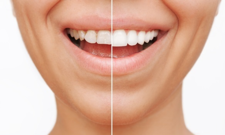 Cosmetic Dentist Arlington
