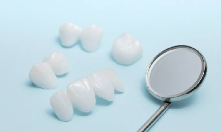 Lumineers Dental Cost Arlington