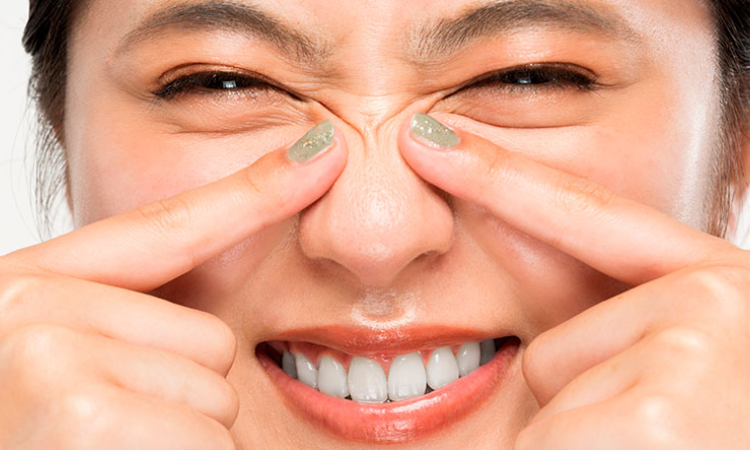 Enlarged Pores Treatment in Arlington