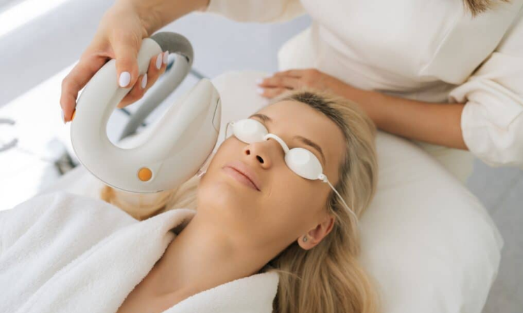 Photofacial Treatment in Arlington