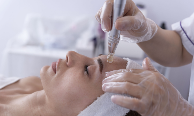 Skin Rejuvenation Treatment in Arlington