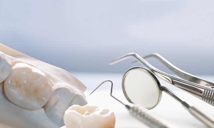 Dental Crowns Arlington