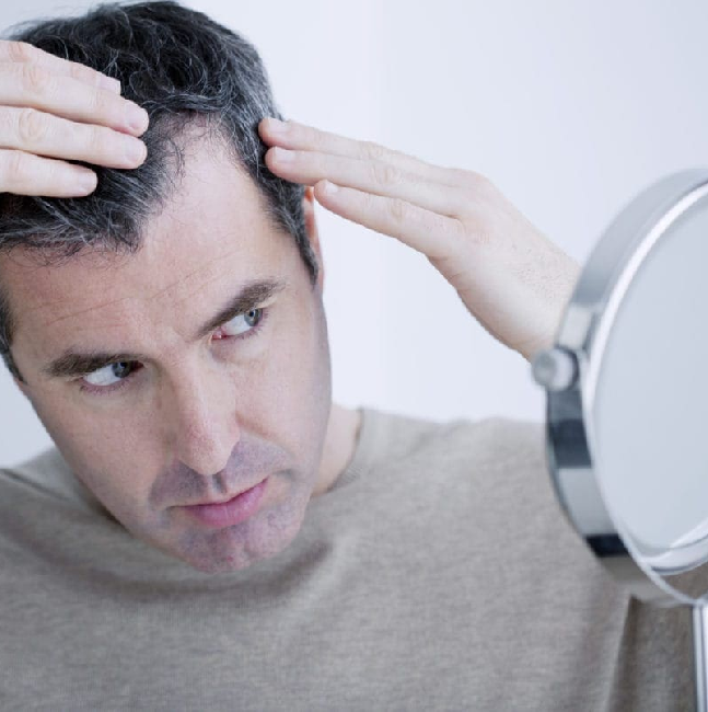 hair-loss hair-loss
