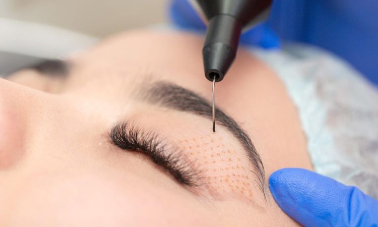 Nonsurgical Eye Lift Treatment in Arlington
