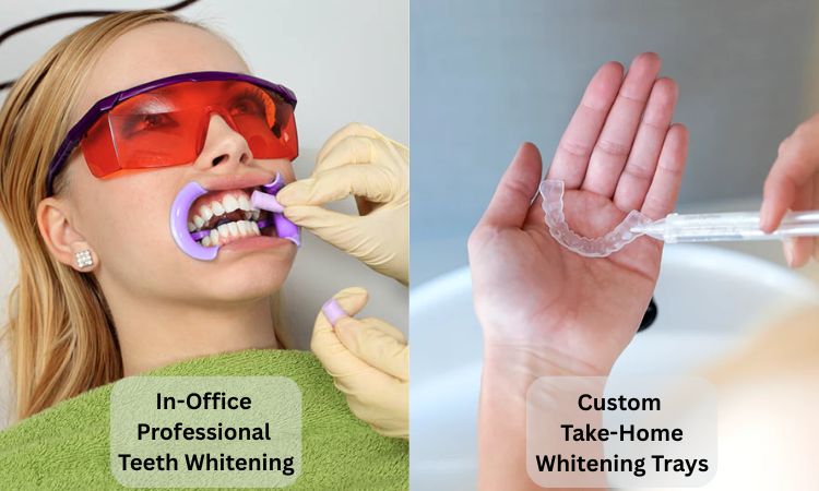 Teeth Whitening Treatment Options
