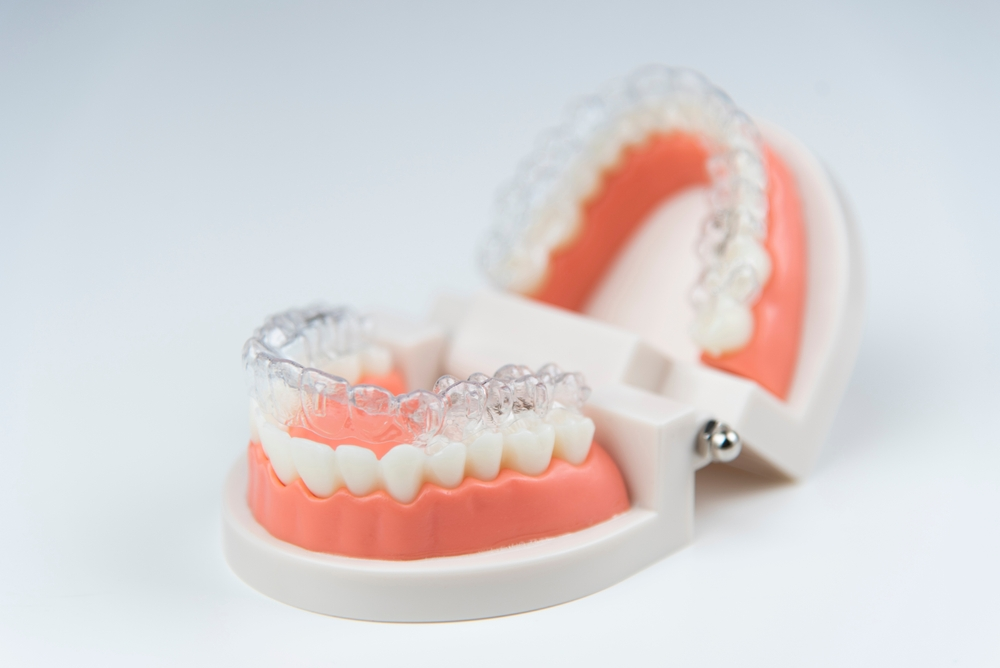 Invisalign Braces in Arlington VA Invisalign Braces in Arlington VA