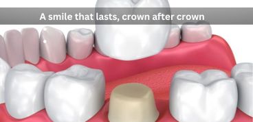 dental crowns in Arlington dental crowns in Arlington