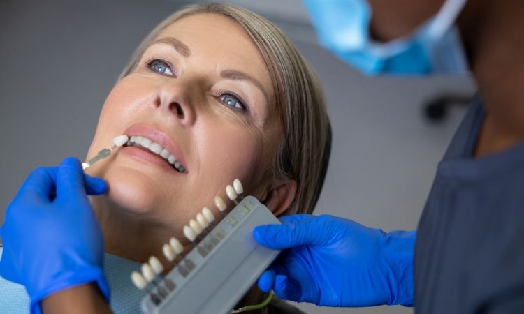 Custom Dental Veneers in Crystal City