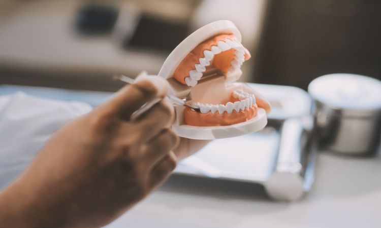 Dental Implants Arlington