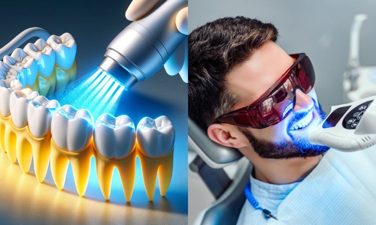 Teeth Whitening Arlington