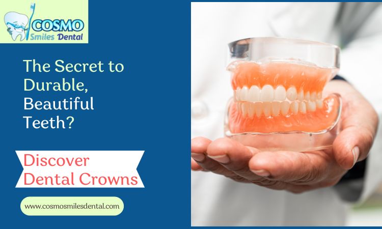 Dental crowns Arlington