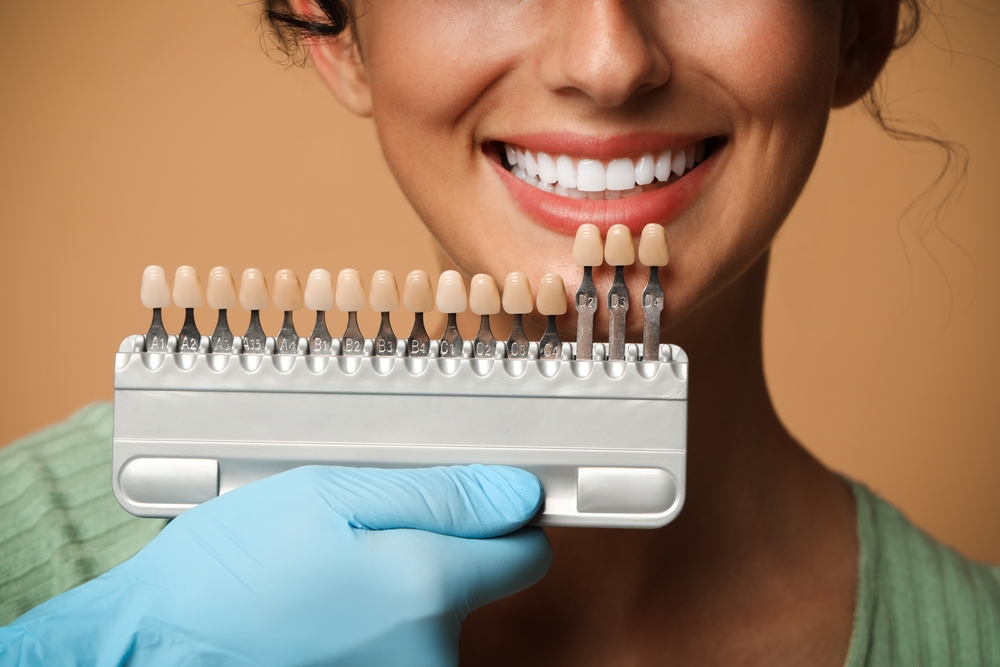 DentalL veneers in arlington