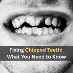 fixing chipped teeth