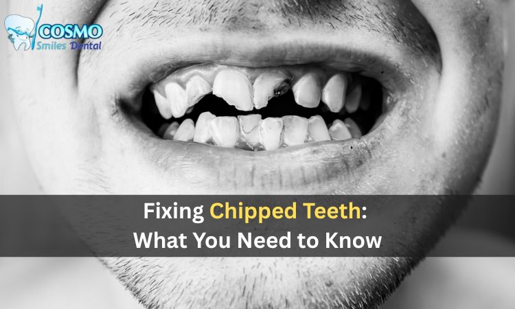 fixing chipped teeth