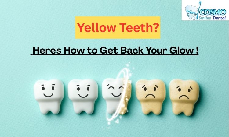 yellow teeth