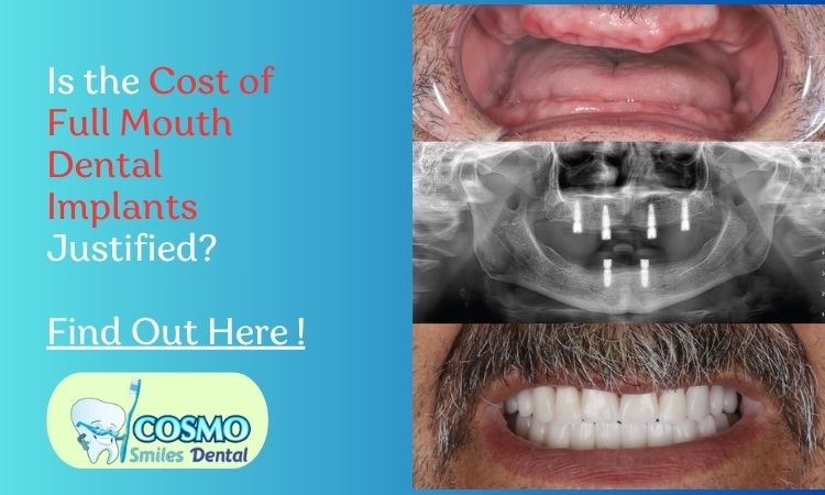 full mouth dental implants cost