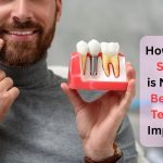 space needed for dental implants arlington