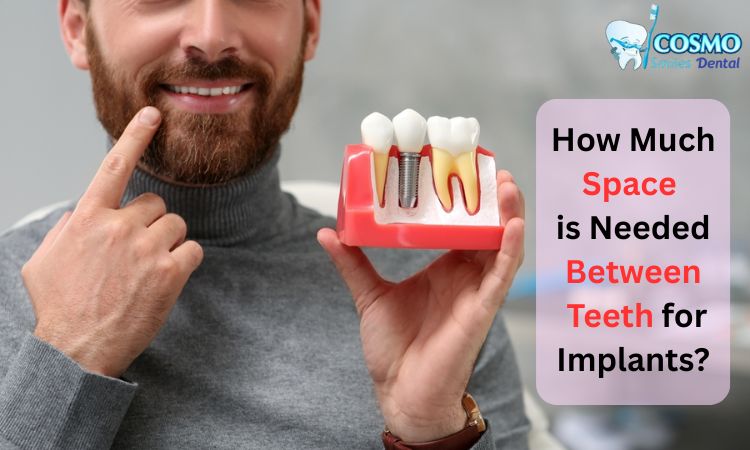 space needed for dental implants arlington