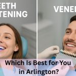 teeth whitening arlington
