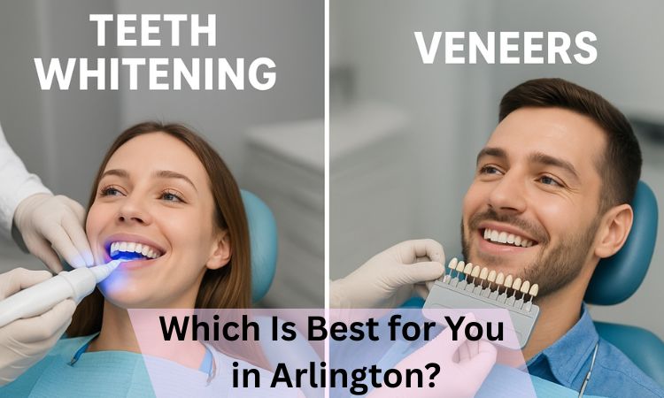 teeth whitening arlington