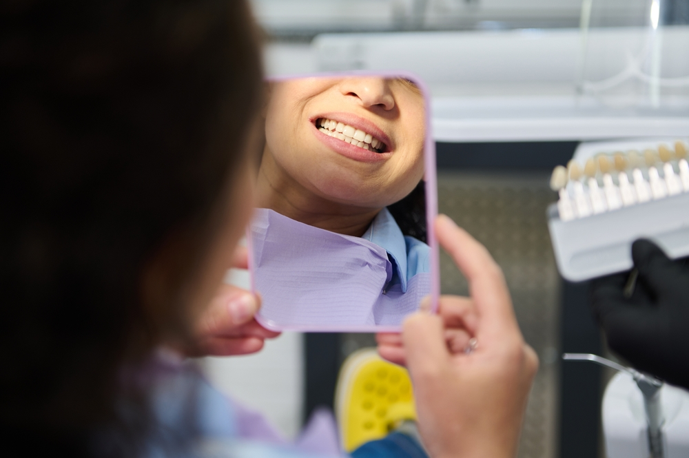 Comparing Teeth Whitening and Veneers