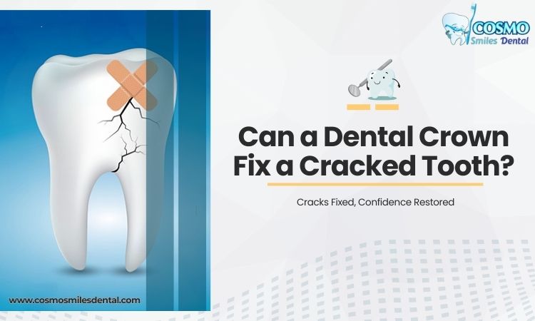 Dental Crown Fix a Cracked Tooth