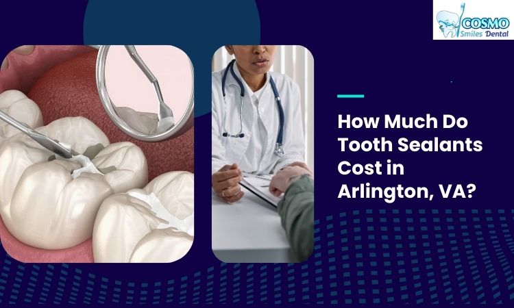 dental sealants cost in arlington