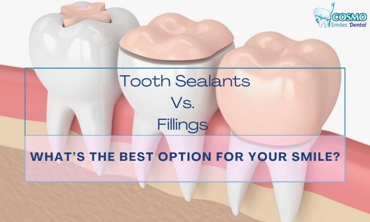 tooth sealants vs fillings arlington