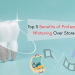 Professional Teeth Whitening