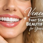 veneers in Arlington
