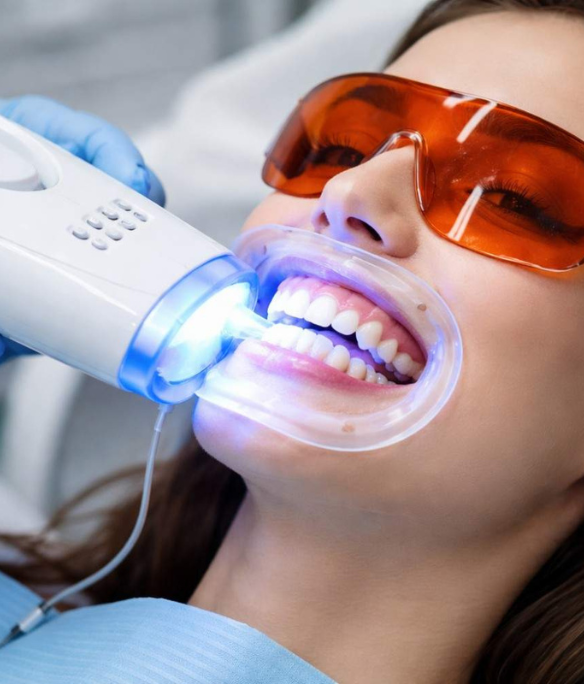 Teeth Whitening 584X684