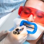 Teeth Whitening in Arlington