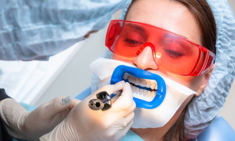 Teeth Whitening in Arlington