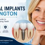 Dental Implants Arlington