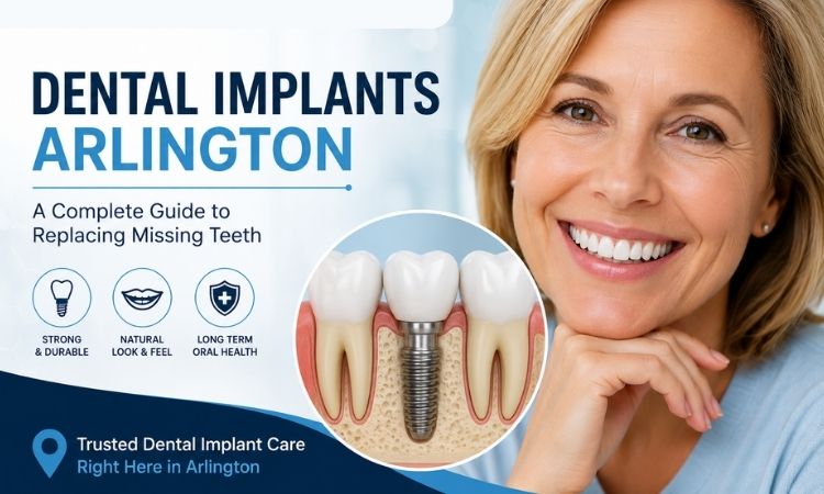 Dental Implants Arlington