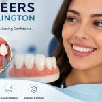 Veneers in Arlington